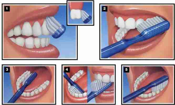 Weird-looking high-tech toothbrush promises a cleaner mouth in 10 seconds